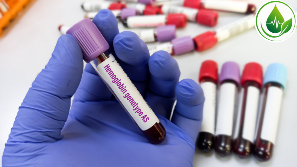 Hemoglobina Glicada: o exame que revela como está o controle da sua glicose